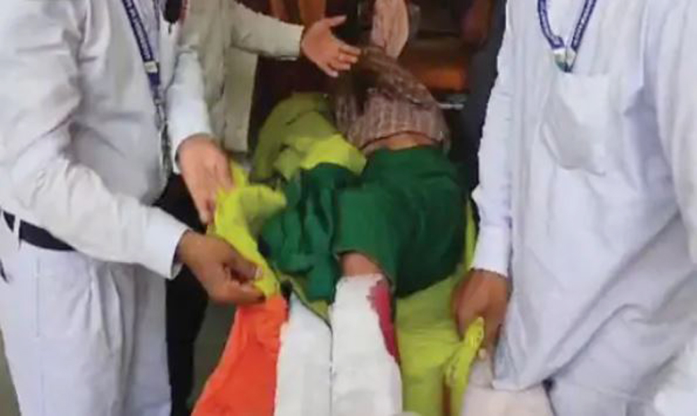 बेटों ने हथौड़े से मां के पैर तोड़े, जमीन अपने नाम कराना चाहते थे, पिता से भी की मारपीट