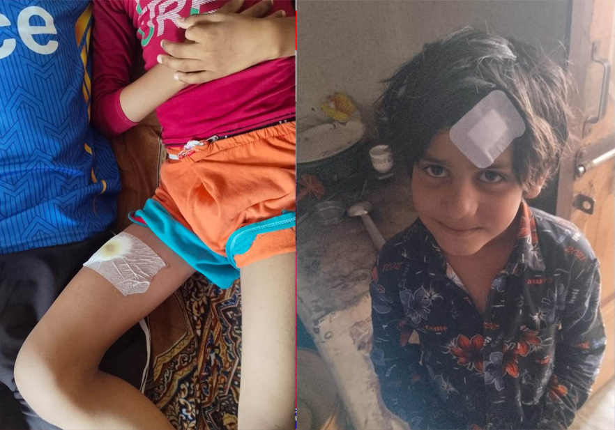 यज्ञ के दौरान झूला टूटने से एक ही परिवार के 4 लोग हुए चोटिल