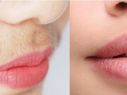 अपर लिप्स के बाल घर पर कैसे हटाएँ, नहीं लगाने पड़ेंगे पार्लर के चक्कर